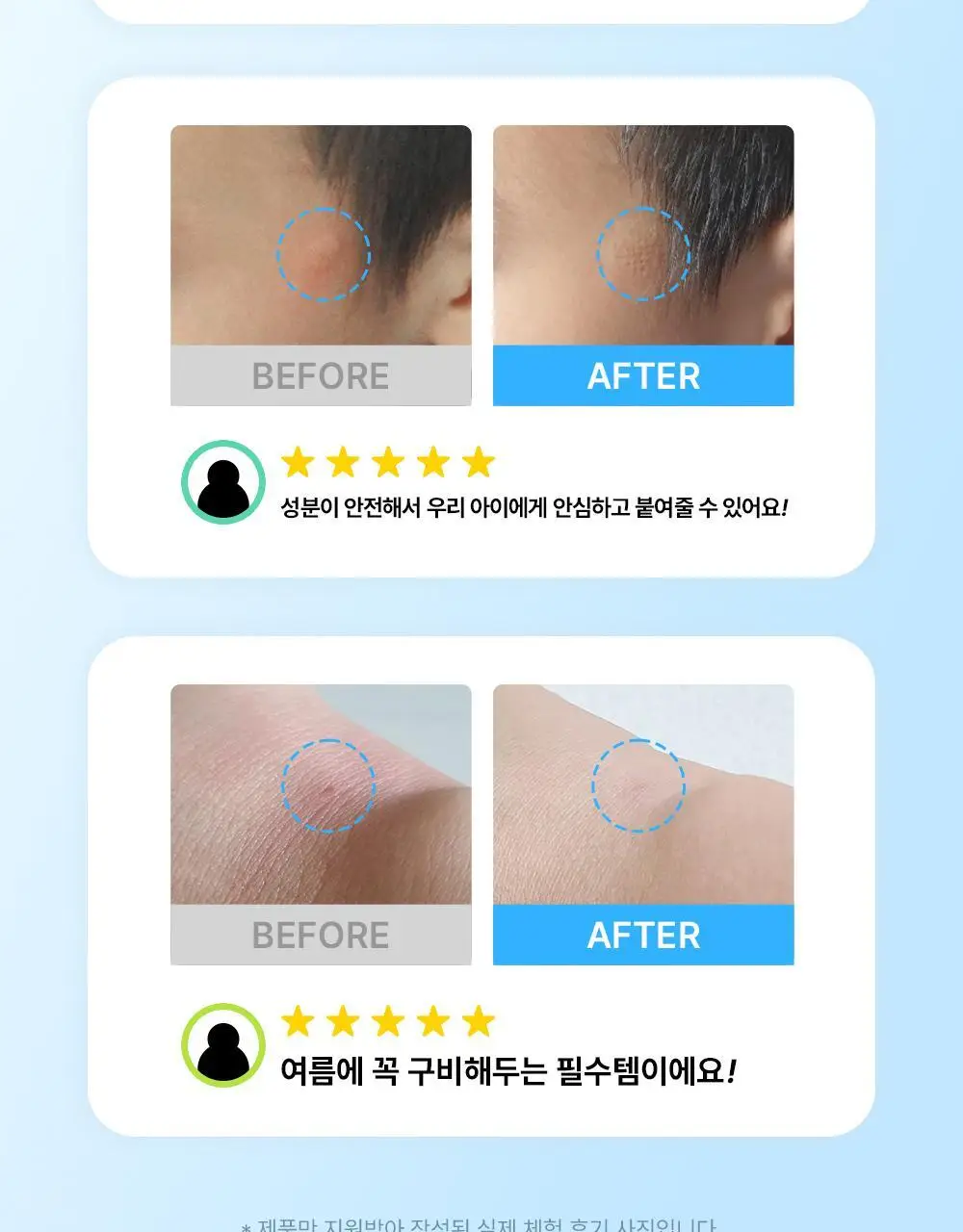 [긁음방지/피부보호] 아크로패스 수딩케어 12매입 상세페이지 3